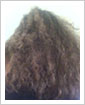 Before Before